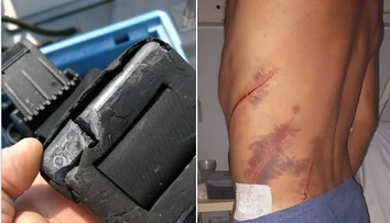 Opitý Čech vrazil člnom do potápača v Chorvátsku. Spôsobil mu hlboké rany až po kosť