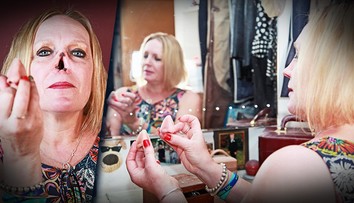 Angličanka má na každú príležitosť iný nos. O ten svoj prišla pre zákernú chorobu