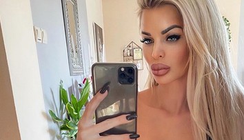 Silvia Kucherenko priznala plastiku: Zverejnila foto pred a po