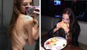 Modelka vydesila trčiacimi rebrami verejnosť. Bráni sa fotkou s hamburgerom