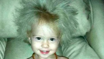 Dievčatko má výnimočné vlasy. Nikdy ich poriadne neučeše