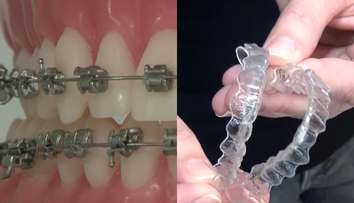 Mnoho dospelých dnes siaha po strojčeku na zuby. Zubní špecialisti radia, aký si vybrať