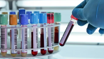 Pre spojenie laboratórií môže dôjsť v bratislavskej nemocnici ku kontaminácii krvi
