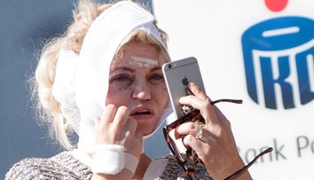 Britská hviezda po plastike v Poľsku. Veľmi jej to nepomohlo