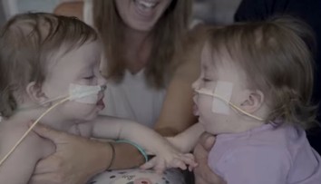 Lekári sa báli, že sa nemusia dožiť operácie. Teraz tieto siamské dvojičky úspešne oddelili