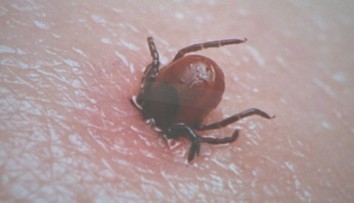 Viete si správne vybrať kliešťa? Na olej a točenie v protismere hodinových ručičiek zabudnite