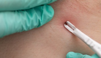 Na Slovensku tento rok evidujú vyše 180 prípadov kliešťovej encefalitídy. Riziko nepodceňujte ani na jeseň