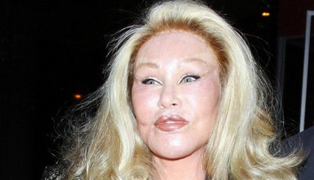 Mačacia žena tvrdí, že nikdy nepodstúpila plastiku. A toto je čo?