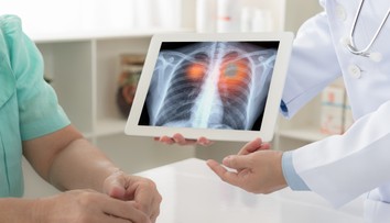 Zjazvené pľúca a problémy s dýchaním. Fibrózu často odhalia až príliš neskoro