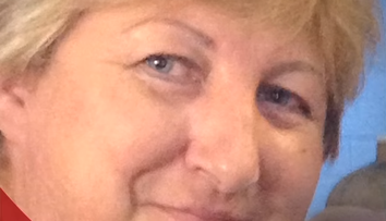 Chcela prirodzený permanentný mejkap. Teraz vyzerá ako klaun