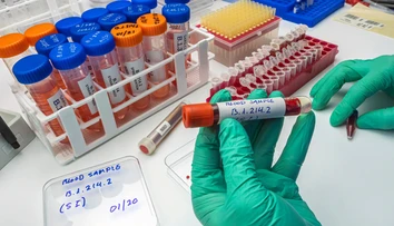 Koordinátor boja proti covidu radí nespoliehať sa na kolektívnu imunitu