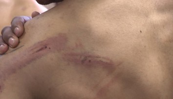 Neprimeraný útok na Rómov má prvého obvineného