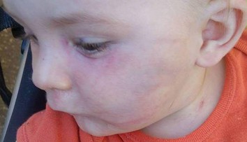 Zúfalá matka! Vychovávateľka jej vraj takto dobila 9-mesačného syna