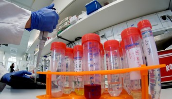 Vedcom sa podarila prevratná vec. Vytvorili zvieracie embryo s ľudskými bunkami