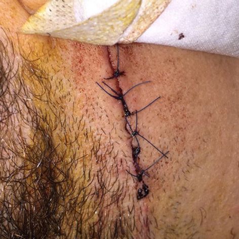 Nehoda v obci Lieskovec.