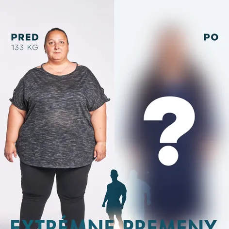 Ružena pred premenou