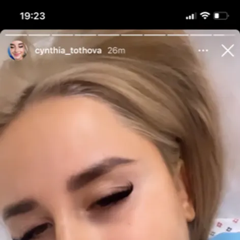 Cynthia absolvovala operačný zákrok