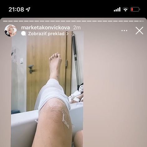 Markéta mala nepríjemné zranenie