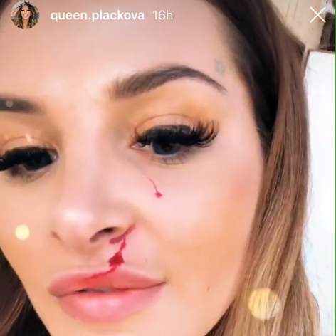 Zuzanu Plačkovú doškriabalo tigrie mláďa. 