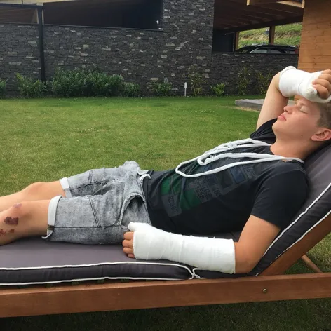 Oliver Oswald po nehode! 