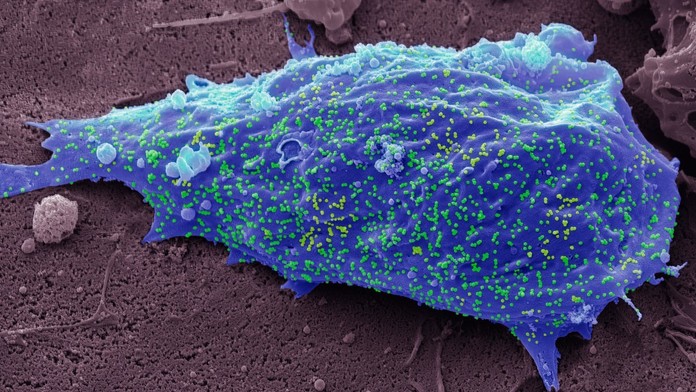 V ČR je nový subvariant omikronu; prekonanie nákazy proti nemu nepomáha
