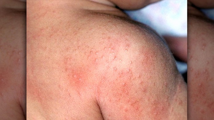 Ilustračná snímka. 