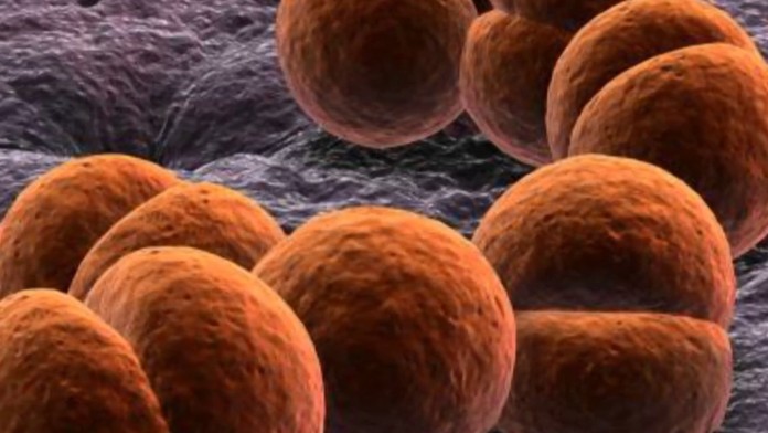 Meningitída má rýchly priebeh.