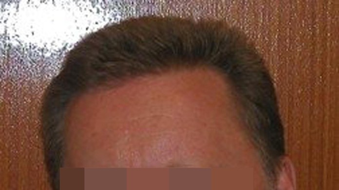 Bývalý riaditeľ Národného onkologického ústavu riaditeľ MUDr. Tomáš Š. 