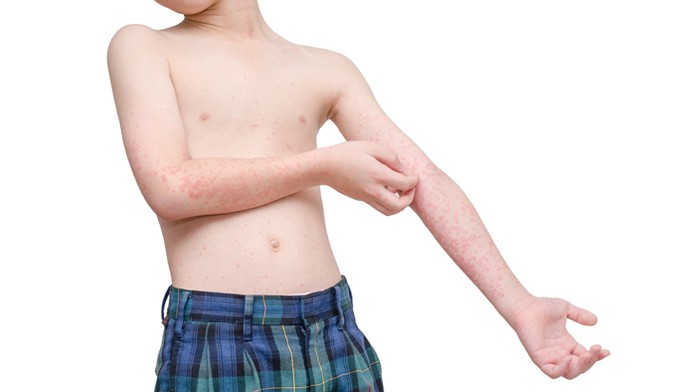 Ilustračná snímka.