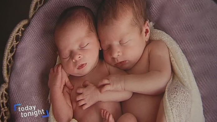 Táto žena otehotnela dvakrát v tom istom čase. Dnes má krásne dievčatká
