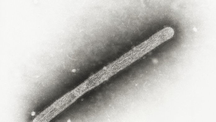 Na snímke z elektrónového mikroskopu z roku 2005 vírus vtáčej chrípky A/H5N1. 