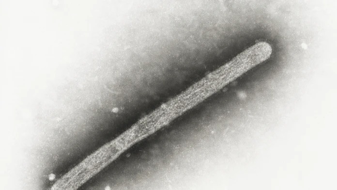 Na snímke z elektrónového mikroskopu z roku 2005 vírus vtáčej chrípky A/H5N1. 