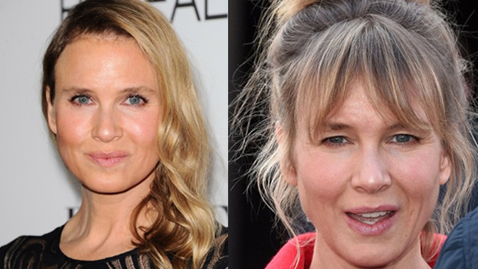 botox.jpg