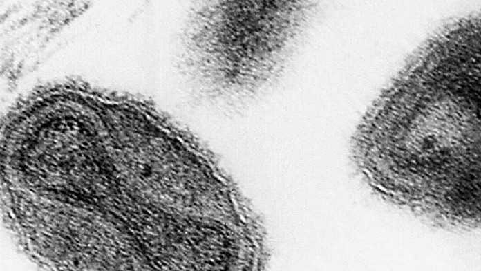 Forgotten_Smallpox-c1613ffb0eb542bfb183650745179c2c.JPEG