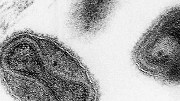 Forgotten_Smallpox-c1613ffb0eb542bfb183650745179c2c.JPEG