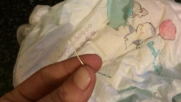 Mamička našla v plienke ihlu