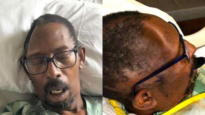 Lekári pred plánovanou operáciou stratili časť lebky pacienta. Reakcia nemocnice je zarážajúca