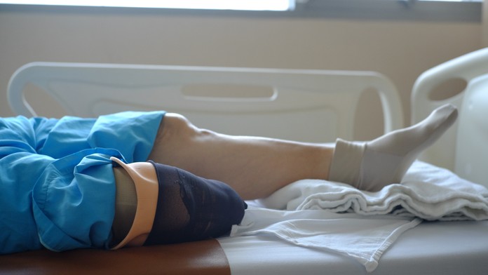 Šokujúce priznanie nemocnice: Šiestim pacientom omylom amputovali končatiny