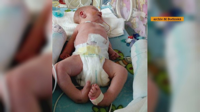 Manželia Kovačičovci v relácii Markíza Backstage