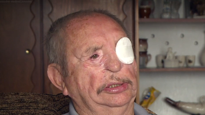 Jána Gejdoša z Liptovských Sliačov zmrzačil medveď