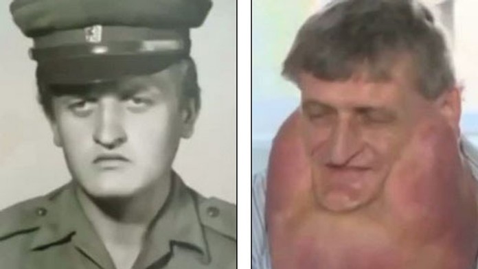 stefan operacia.jpg
