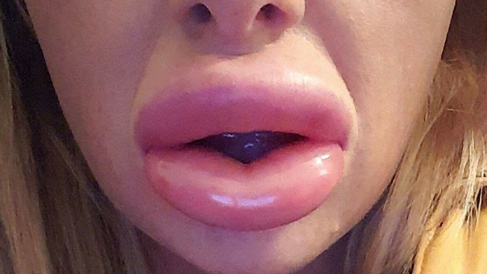 Svoje pery prirovnala k surovej klobáse.