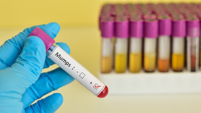 Mumps