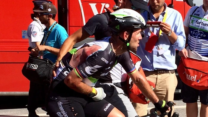 Doráňaný Mark Cavendish po 4. etape.