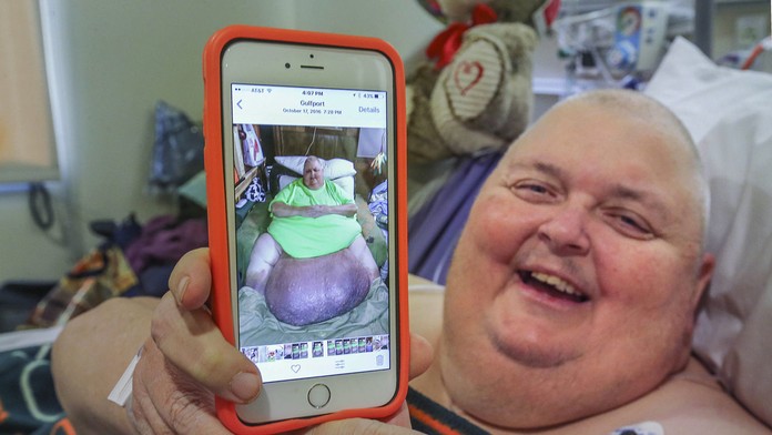 Tumor mu už nedovolil chodiť.