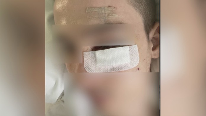 Zbitý 22-ročný mladík v Prešove.