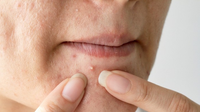 Ilustračná snímka