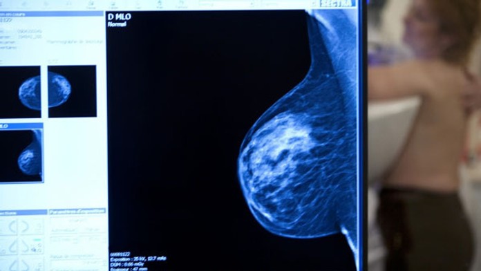 Vyšetrenie prsníka