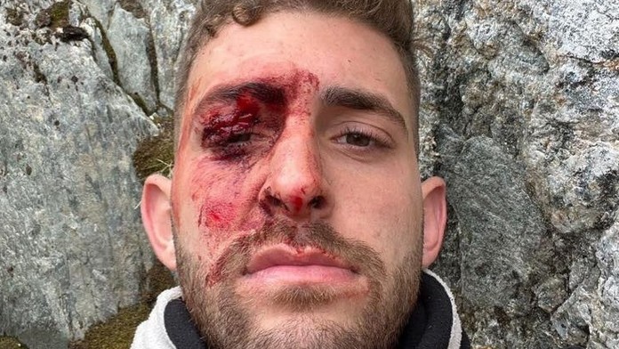 Pri Eitanovi Shakedovi (23) stáli počas výstupu na ľadovec všetci svätí.