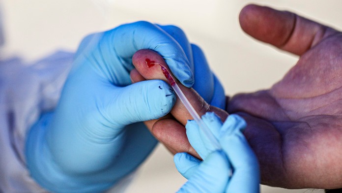 Rýchlotest na COVID-19.